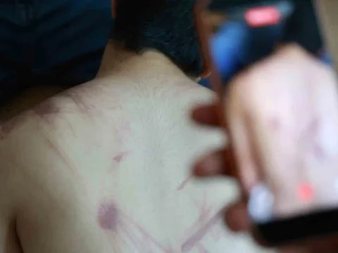 Elazigda rehabilitasyon merkezinde siddet iddiasi adli ve idari sorusturma baslatildi AIxrfWnv